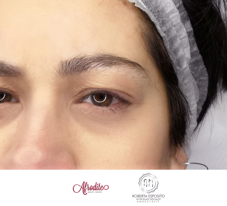 Prima del microblading