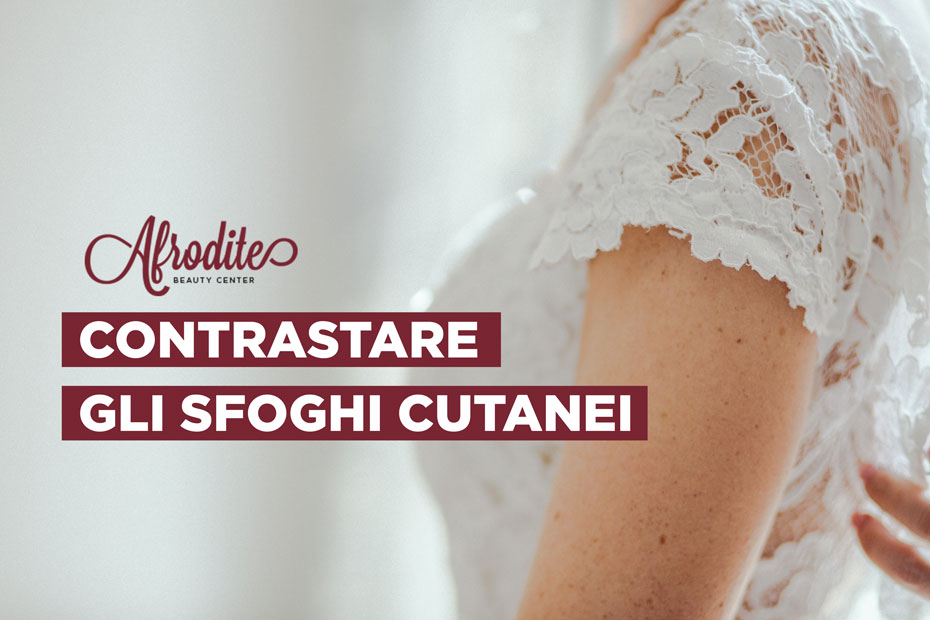 Come curare gli sfoghi cutanei pre-nozze